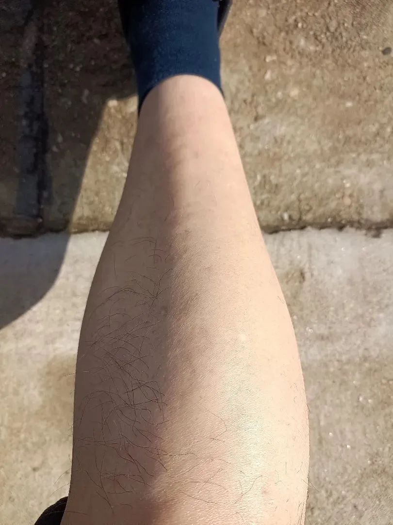 网约车司机脱发真凶竟是电车？科学解析辐射真相与健康关系插图